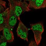 RDH8 Polyclonal Antibody