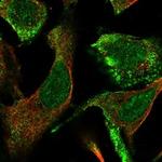 CLCA4 Polyclonal Antibody