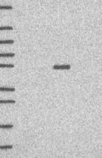 LRRC2 Antibody in Western Blot (WB)
