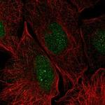 Galectin 14 Antibody in Immunocytochemistry (ICC/IF)