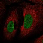 CHD9 Polyclonal Antibody