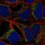 ANKRD63 Polyclonal Antibody