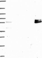 ADAMTS16 Antibody in Western Blot (WB)