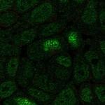 HOXA13 Polyclonal Antibody