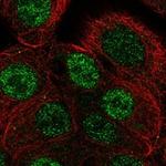 ANP32B Polyclonal Antibody