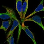 ROBO3 Polyclonal Antibody