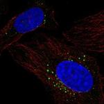 PRCP Antibody in Immunocytochemistry (ICC/IF)
