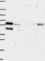 PRCP Antibody in Western Blot (WB)