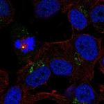 TRPM1 Polyclonal Antibody