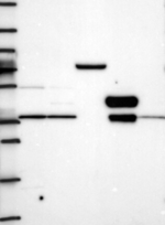 TSPAN15 Antibody in Western Blot (WB)