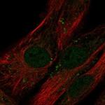LRRC17 Polyclonal Antibody