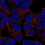 DIO3 Polyclonal Antibody