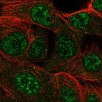 CMYA5 Polyclonal Antibody