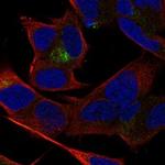 TSNARE1 Polyclonal Antibody