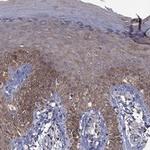 TSNARE1 Antibody in Immunohistochemistry (Paraffin) (IHC (P))