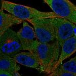 PMM1 Polyclonal Antibody