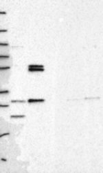 PMM1 Antibody in Western Blot (WB)