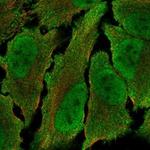 TOGARAM2 Polyclonal Antibody