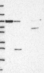 VAC14 Antibody in Western Blot (WB)