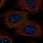 BATF3 Polyclonal Antibody