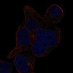 LRRCC1 Polyclonal Antibody