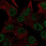 CEMP1 Polyclonal Antibody