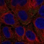 Fancd2os Polyclonal Antibody