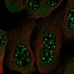 HDBP2 Polyclonal Antibody