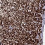 HDBP2 Antibody in Immunohistochemistry (Paraffin) (IHC (P))