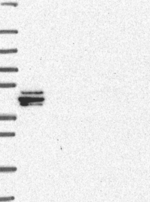 HDBP2 Antibody in Western Blot (WB)