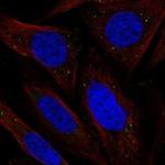CHRDL2 Antibody in Immunocytochemistry (ICC/IF)