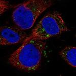 IQSEC2 Polyclonal Antibody