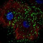 KLHDC7B Polyclonal Antibody