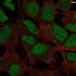 HMGXB4 Polyclonal Antibody