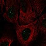 SMIM2 Polyclonal Antibody