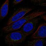 TMEM168 Polyclonal Antibody