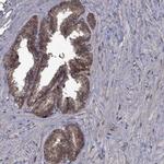 GPAA1 Antibody in Immunohistochemistry (Paraffin) (IHC (P))