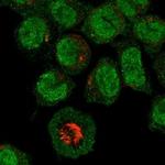 MEFV Polyclonal Antibody