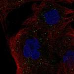 HLA-DMB Polyclonal Antibody