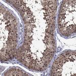 POU5F2 Antibody in Immunohistochemistry (Paraffin) (IHC (P))