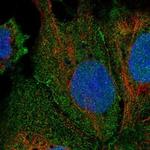 LRRC9 Polyclonal Antibody