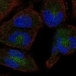 HPS5 Polyclonal Antibody