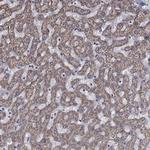 HPS5 Antibody in Immunohistochemistry (Paraffin) (IHC (P))