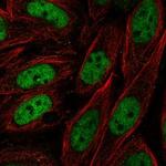 ZNF843 Polyclonal Antibody