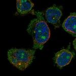 CCDC168 Polyclonal Antibody