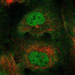 RBM46 Polyclonal Antibody