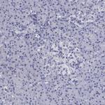 SLC51A Antibody in Immunohistochemistry (Paraffin) (IHC (P))