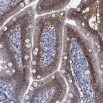 SLC51A Antibody in Immunohistochemistry (Paraffin) (IHC (P))