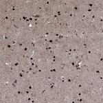 PRICKLE4 Polyclonal Antibody