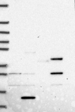 PRICKLE4 Antibody in Western Blot (WB)